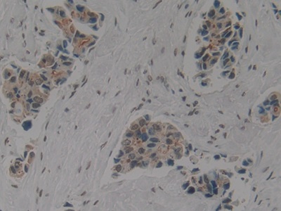 Polyclonal Antibody to Cytokeratin 1 (CK1)