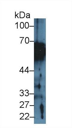 Polyclonal Antibody to Cytokeratin 1 (CK1)