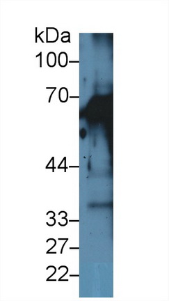 Polyclonal Antibody to Cytokeratin 1 (CK1)