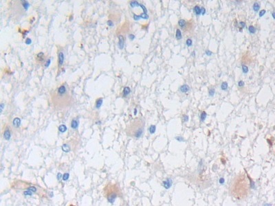 Polyclonal Antibody to Nestin (NES)