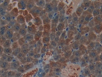 Polyclonal Antibody to Natriuretic Peptide Precursor B (NPPB)