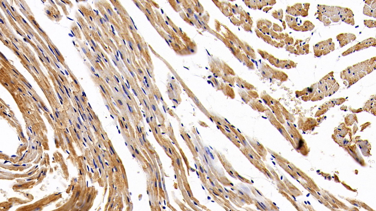 Polyclonal Antibody to Natriuretic Peptide Precursor B (NPPB)