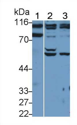 Polyclonal Antibody to Protein Kinase D2 (PKD2)