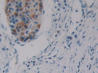 Polyclonal Antibody to Serum Response Factor (SRF)