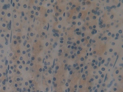 Polyclonal Antibody to Cytokeratin 15 (CK15)