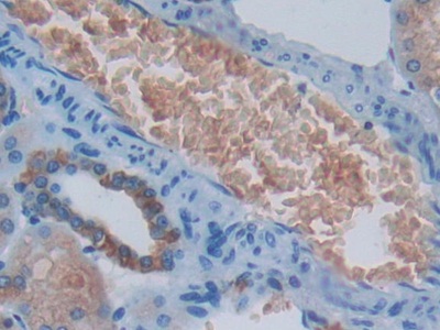 Polyclonal Antibody to Protein Kinase R (PKR)