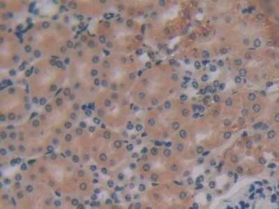 Polyclonal Antibody to Protein Kinase R (PKR)