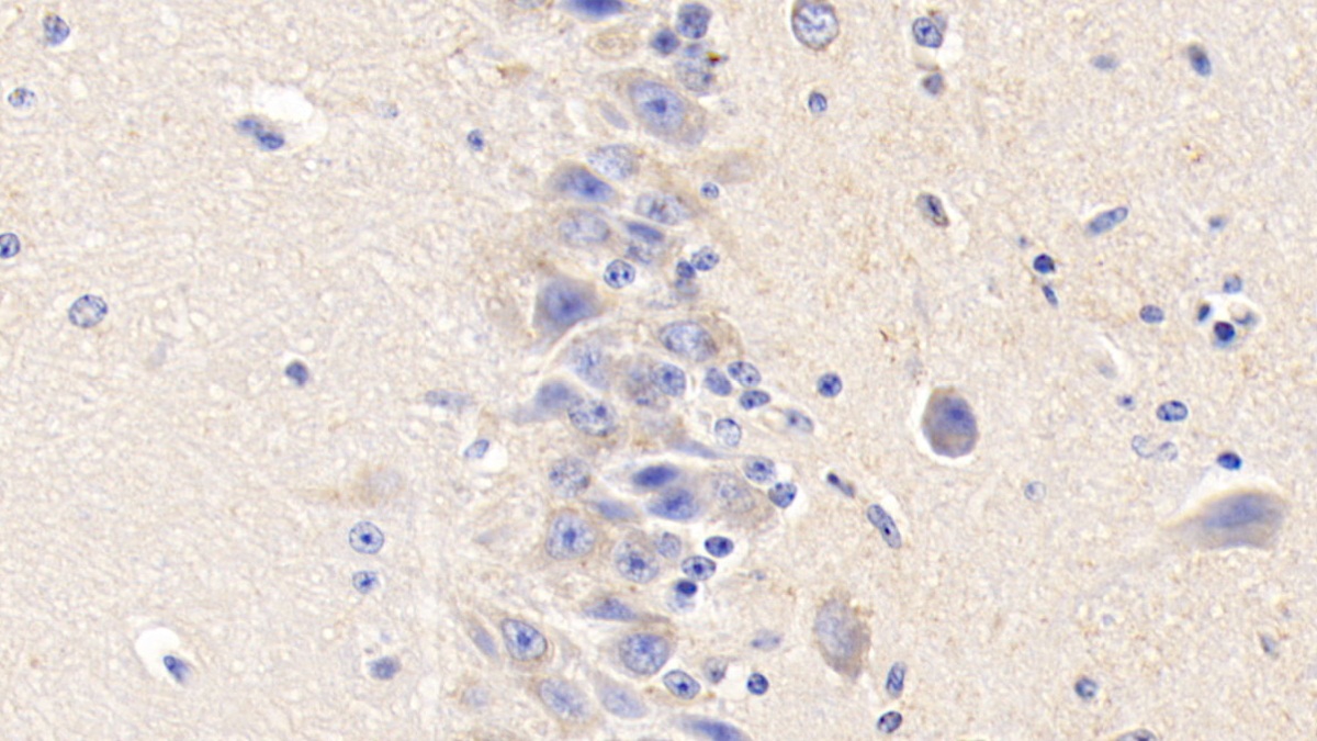 Polyclonal Antibody to Tissue Factor (TF)