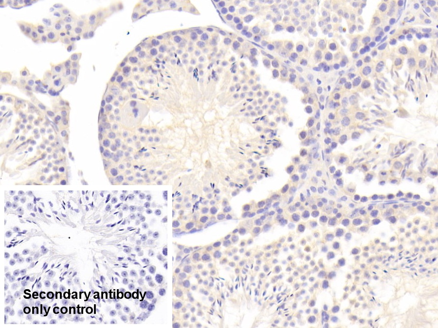 Polyclonal Antibody to Tissue Plasminogen Activator (tPA)