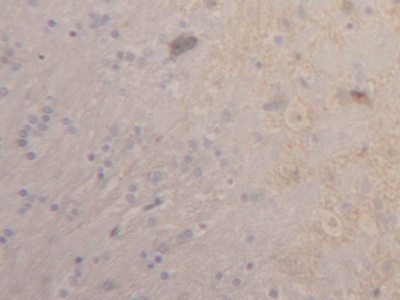 Polyclonal Antibody to Thrombomodulin (TM)