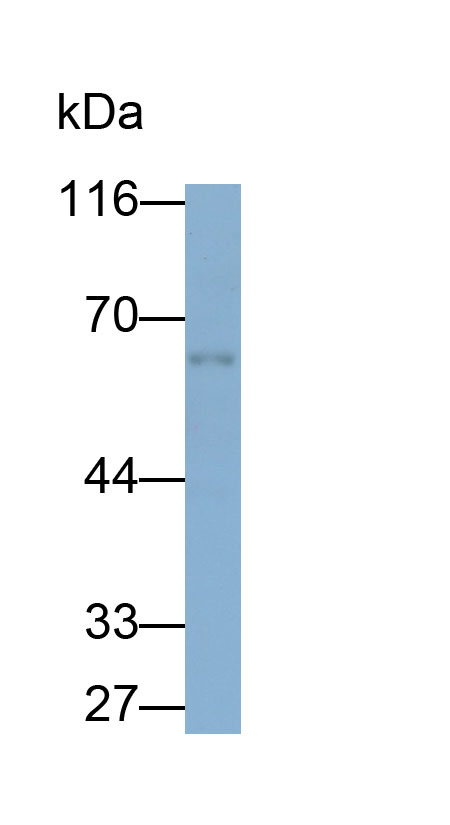 Polyclonal Antibody to Thrombomodulin (TM)