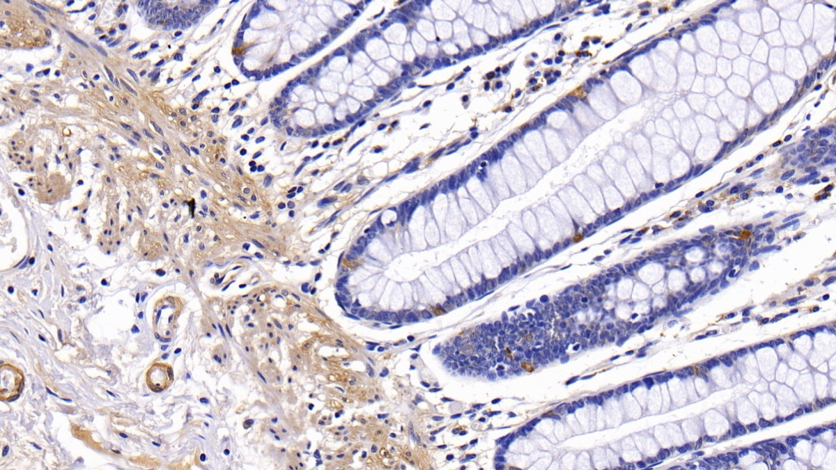 Polyclonal Antibody to Plasminogen Activator Inhibitor 1 (PAI1)