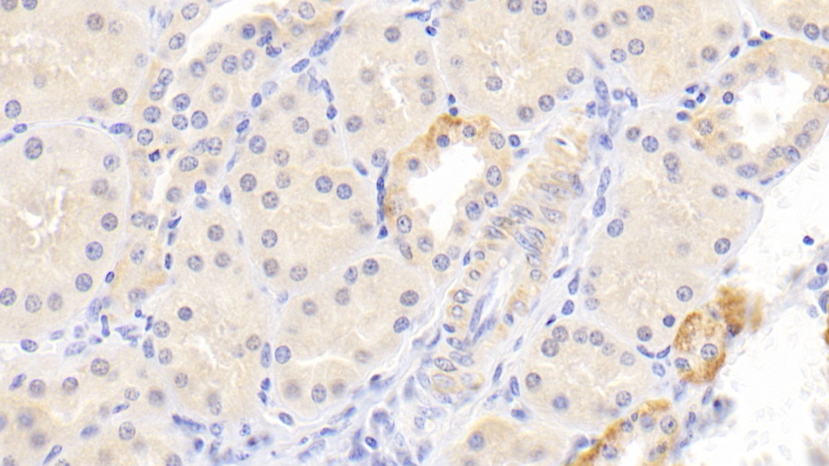 Polyclonal Antibody to Plasminogen Activator Inhibitor 1 (PAI1)