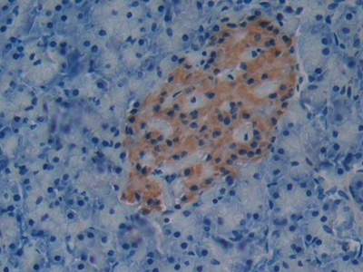 Polyclonal Antibody to Plasminogen Activator Inhibitor 1 (PAI1)