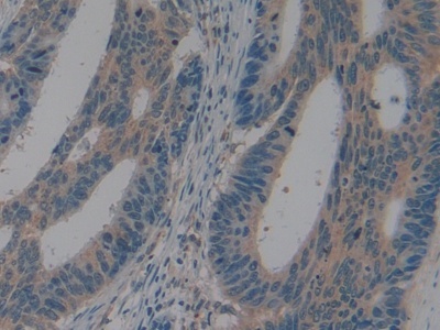 Polyclonal Antibody to Leucine Aminopeptidase (LAP)