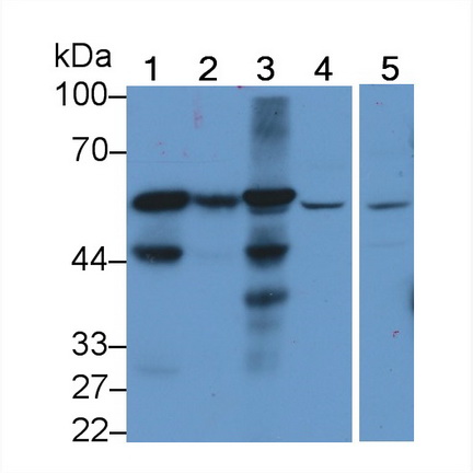 Polyclonal Antibody to Leucine Aminopeptidase (LAP)