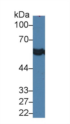 Polyclonal Antibody to Leucine Aminopeptidase (LAP)