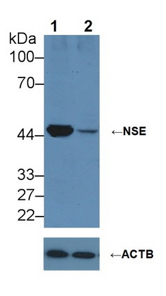 Polyclonal Antibody to Enolase, Neuron Specific (NSE)