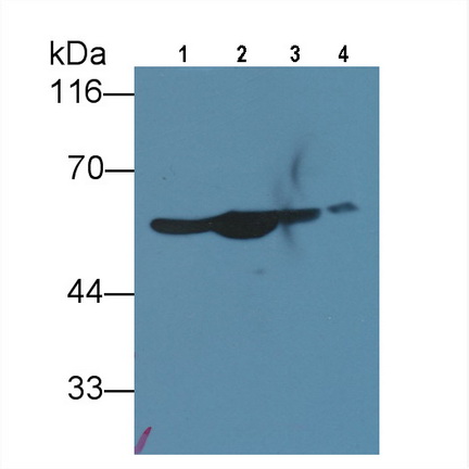 Polyclonal Antibody to Enolase, Neuron Specific (NSE)