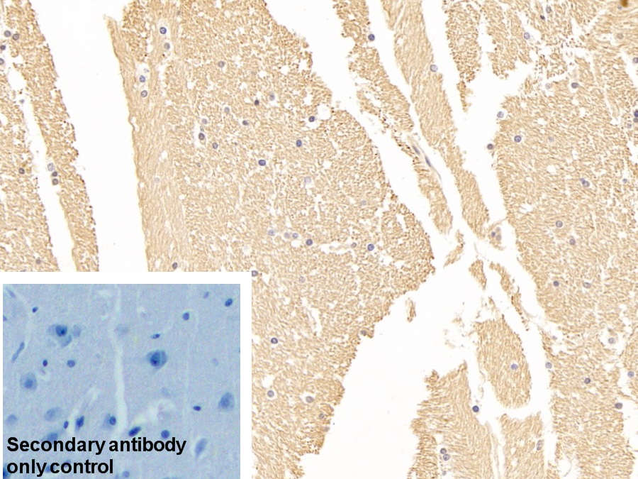 Polyclonal Antibody to Enolase, Neuron Specific (NSE)