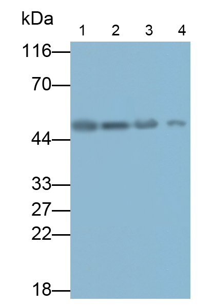 Polyclonal Antibody to Enolase, Neuron Specific (NSE)