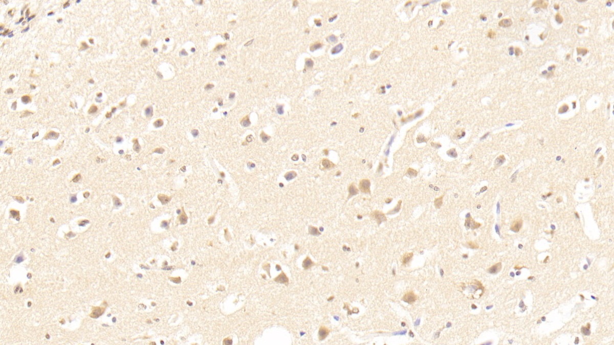 Polyclonal Antibody to Enolase, Neuron Specific (NSE)