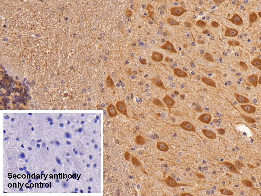 Polyclonal Antibody to Enolase, Neuron Specific (NSE)