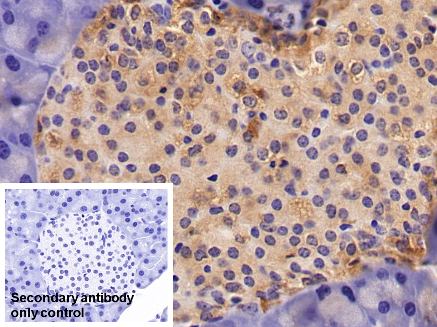 Polyclonal Antibody to Enolase, Neuron Specific (NSE)