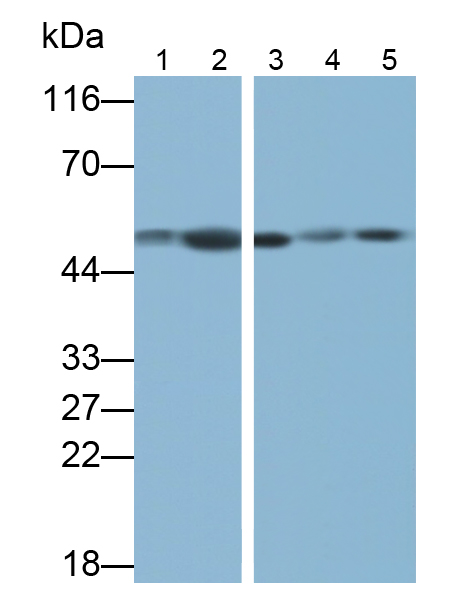 Polyclonal Antibody to Enolase, Neuron Specific (NSE)