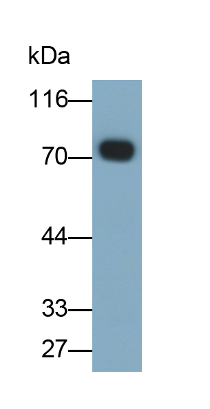 Polyclonal Antibody to Immunoglobulin M (IgM)