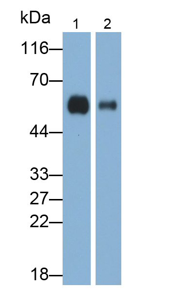 Polyclonal Antibody to Immunoglobulin G (IgG)