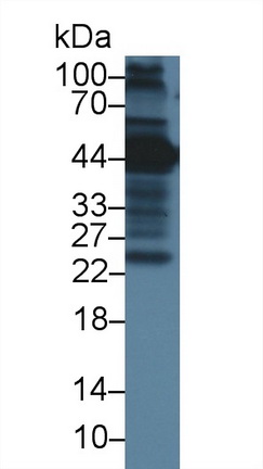 Polyclonal Antibody to Immunoglobulin G (IgG)