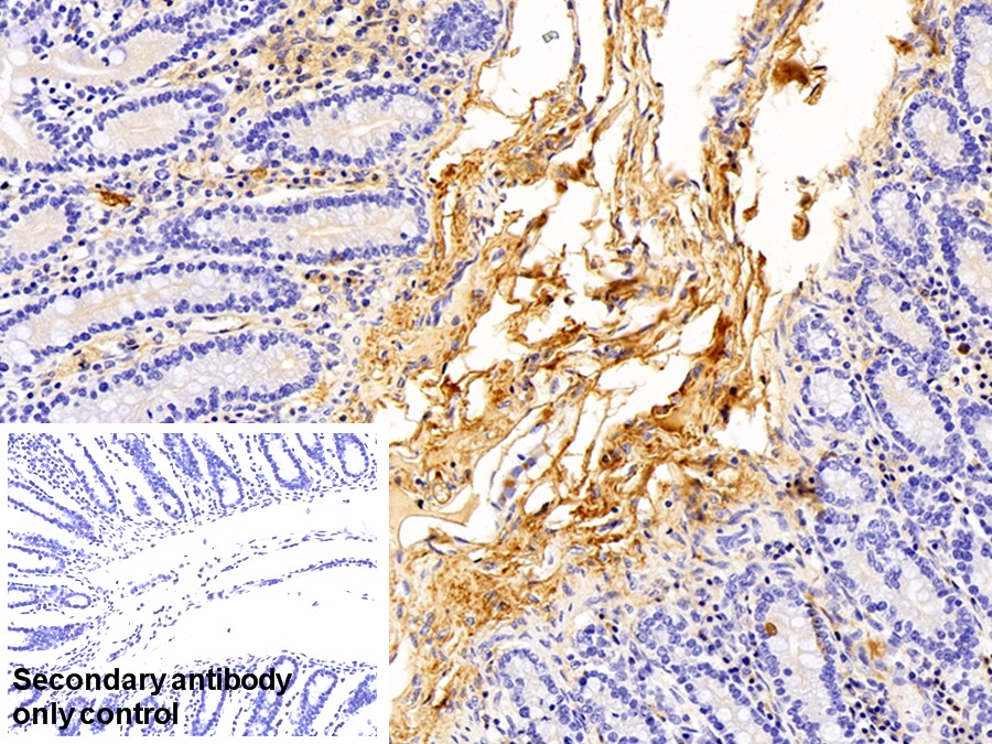 Polyclonal Antibody to Immunoglobulin G (IgG)