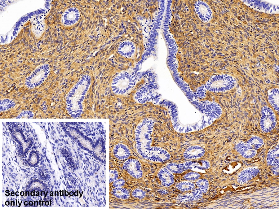 Polyclonal Antibody to Immunoglobulin G (IgG)