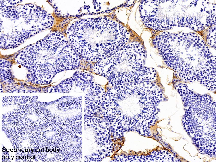 Polyclonal Antibody to Immunoglobulin G (IgG)