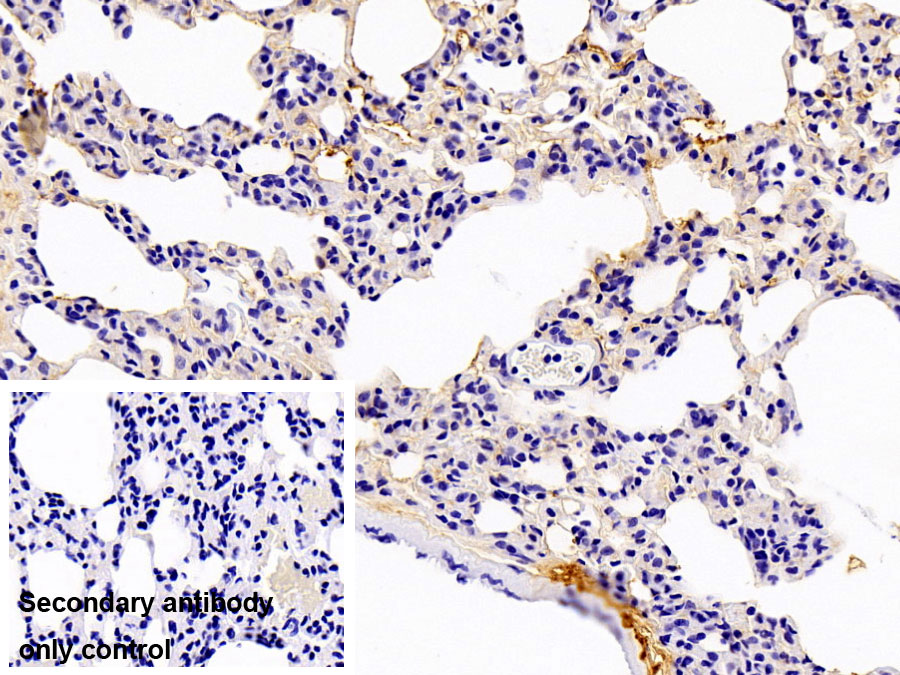 Polyclonal Antibody to Immunoglobulin A (IgA)