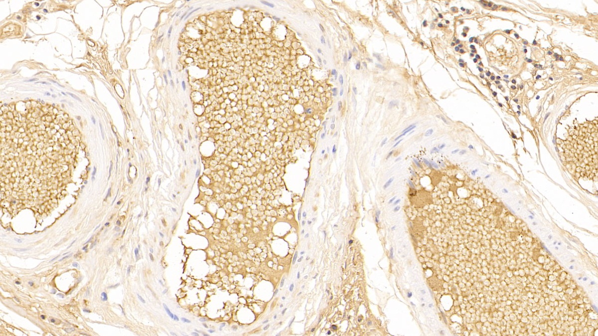 Polyclonal Antibody to Immunoglobulin A (IgA)