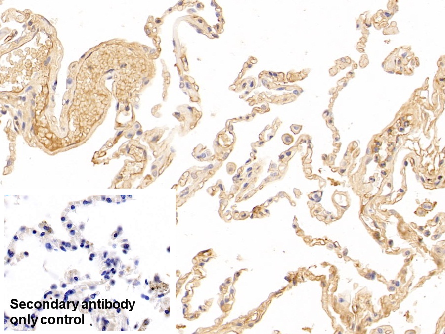 Polyclonal Antibody to Immunoglobulin A (IgA)