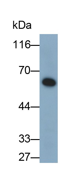 Polyclonal Antibody to Immunoglobulin A (IgA)