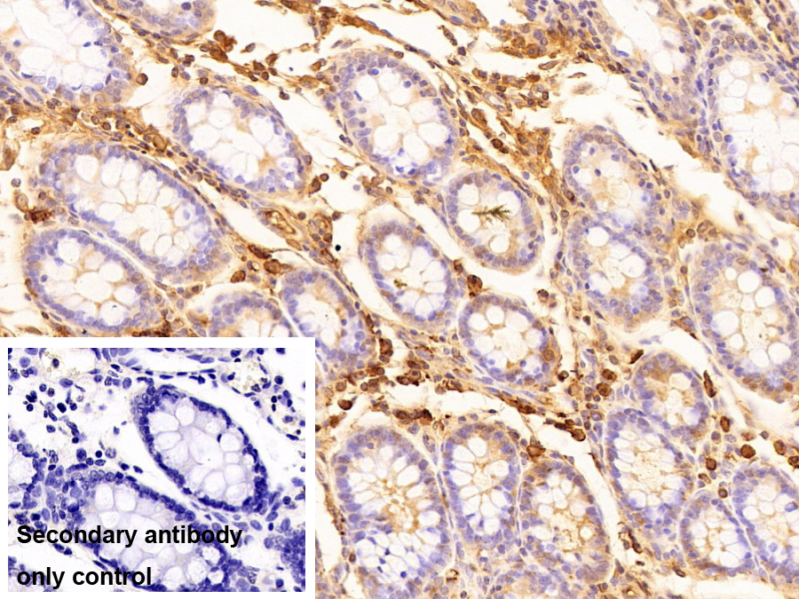 Polyclonal Antibody to Immunoglobulin A (IgA)