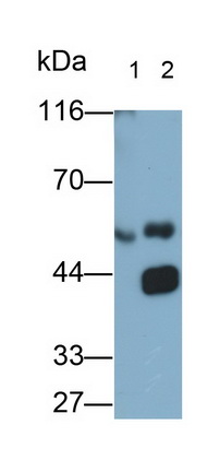 Polyclonal Antibody to Immunoglobulin A (IgA)