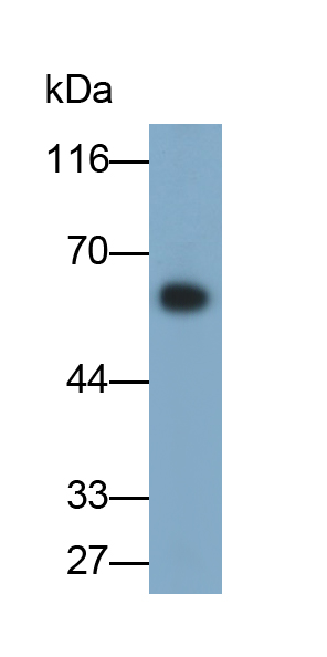 Polyclonal Antibody to Immunoglobulin A (IgA)