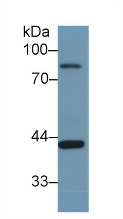 Polyclonal Antibody to Vascular Cell Adhesion Molecule 1 (VCAM1)