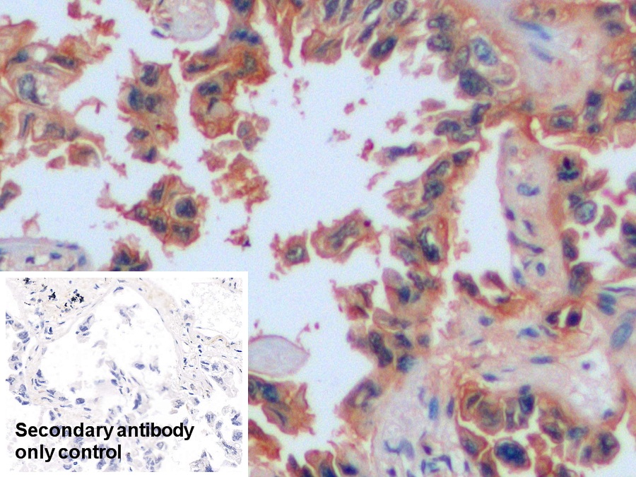 Polyclonal Antibody to Intercellular Adhesion Molecule 1 (ICAM1)