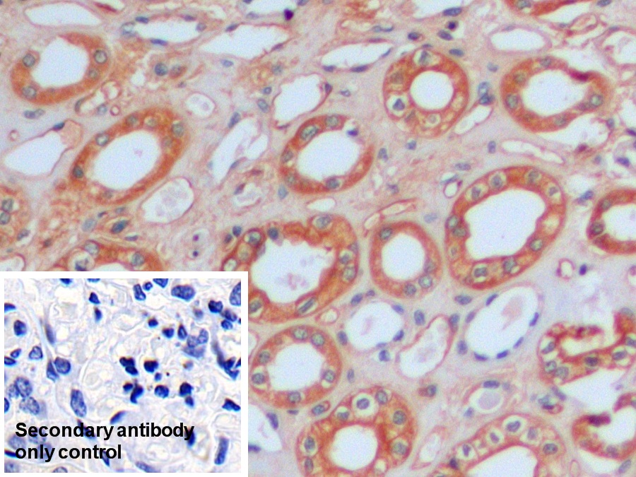 Polyclonal Antibody to Intercellular Adhesion Molecule 1 (ICAM1)