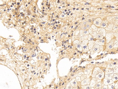 Polyclonal Antibody to Intercellular Adhesion Molecule 1 (ICAM1)