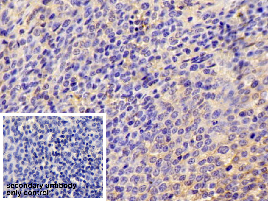 Polyclonal Antibody to Intercellular Adhesion Molecule 1 (ICAM1)