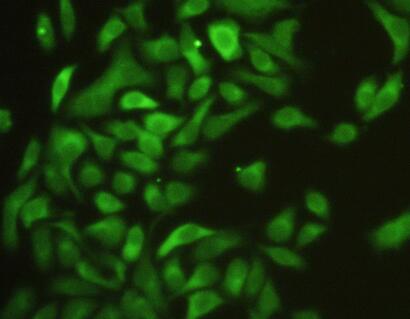 Polyclonal Antibody to Intercellular Adhesion Molecule 1 (ICAM1)