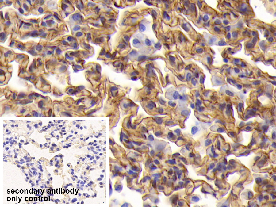 Polyclonal Antibody to Intercellular Adhesion Molecule 1 (ICAM1)