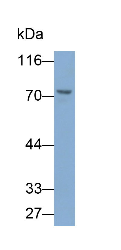 Polyclonal Antibody to Matrix Metalloproteinase 9 (MMP9)